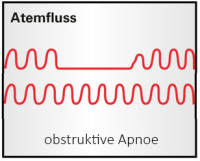 {{ :obstruktive_apnoe.png?200|{{:obstruktive_apnoe.png?200|